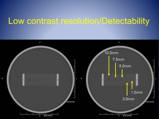 Contrast Resolution Imaging Qa of ct and mamography | PPT
