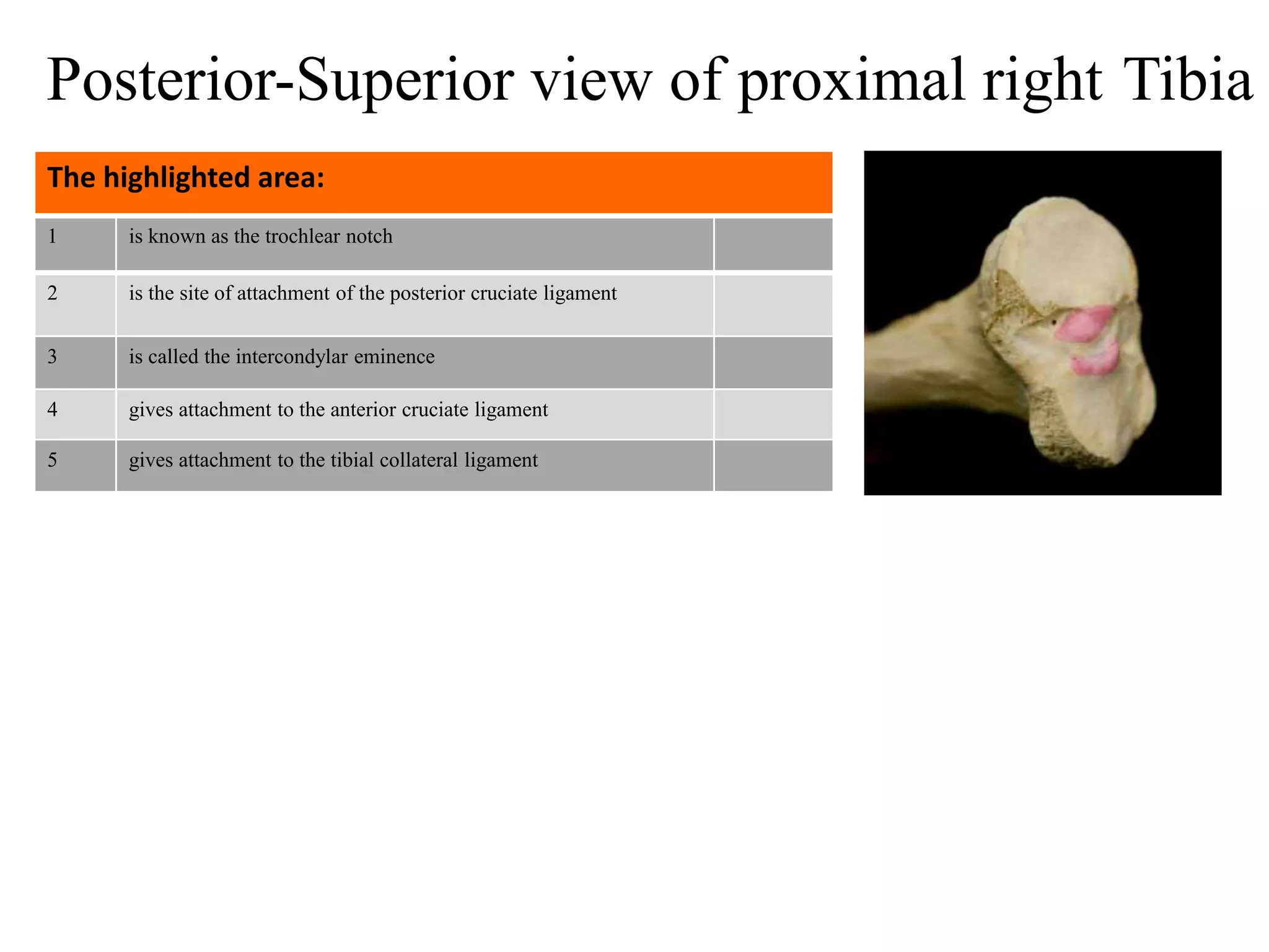 1 is known as the trochlear notch
2 is the site of attachment of the posterior cruciate ligament
3 is called the intercondylar eminence
4 gives attachment to the anterior cruciate ligament
5 gives attachment to the tibial collateral ligament
The highlighted area:
Posterior-Superior view of proximal right Tibia
 