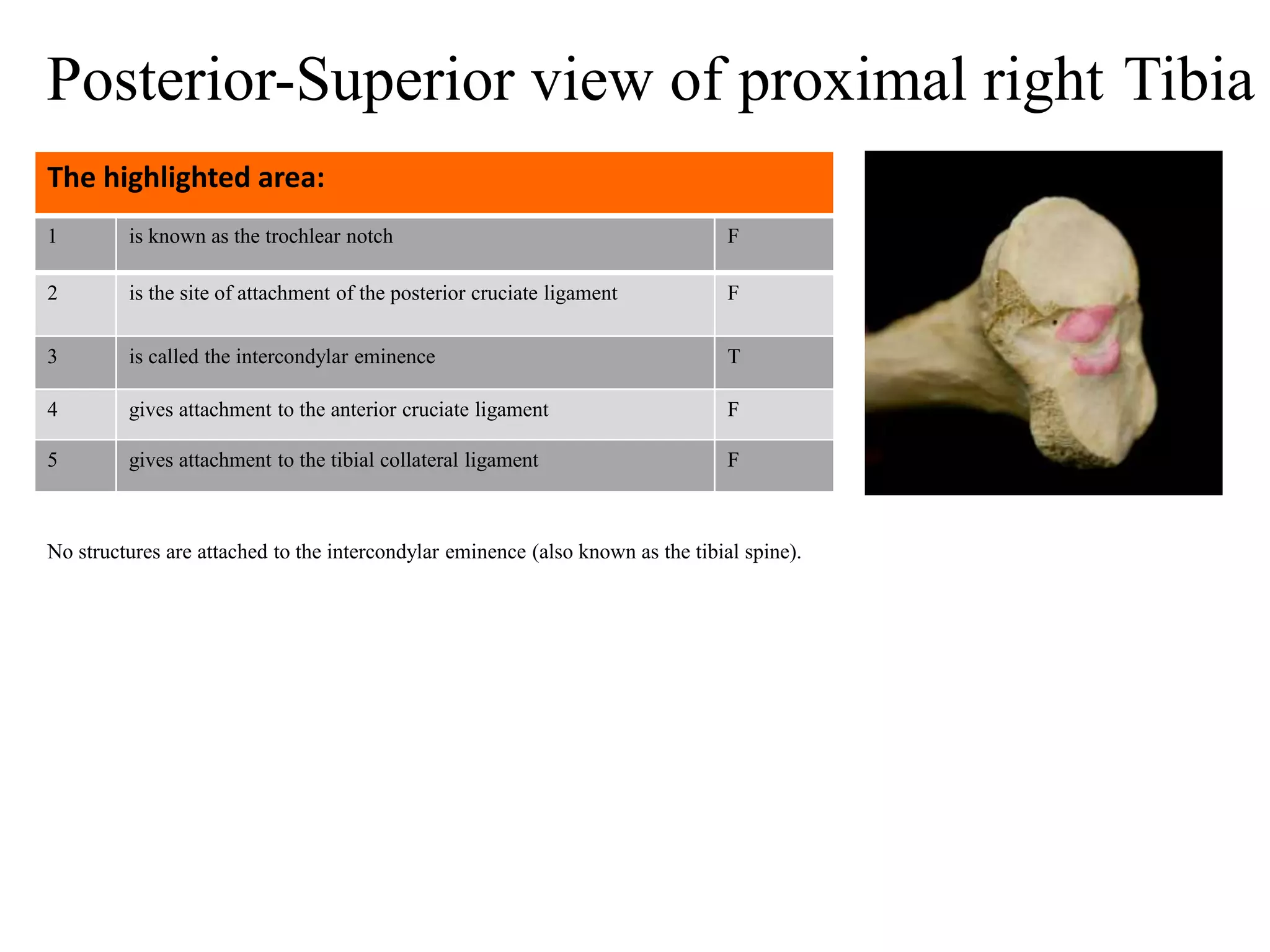1 is known as the trochlear notch F
2 is the site of attachment of the posterior cruciate ligament F
3 is called the intercondylar eminence T
4 gives attachment to the anterior cruciate ligament F
5 gives attachment to the tibial collateral ligament F
The highlighted area:
No structures are attached to the intercondylar eminence (also known as the tibial spine).
Posterior-Superior view of proximal right Tibia
 