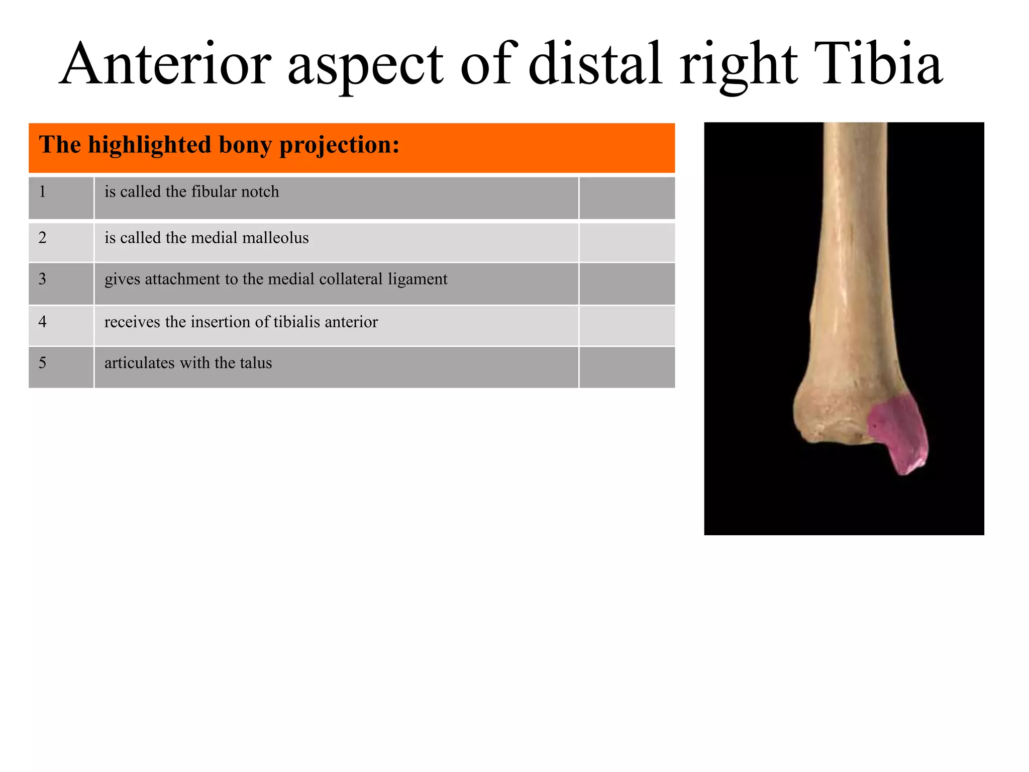 1 is called the fibular notch
2 is called the medial malleolus
3 gives attachment to the medial collateral ligament
4 receives the insertion of tibialis anterior
5 articulates with the talus
The highlighted bony projection:
Anterior aspect of distal right Tibia
 