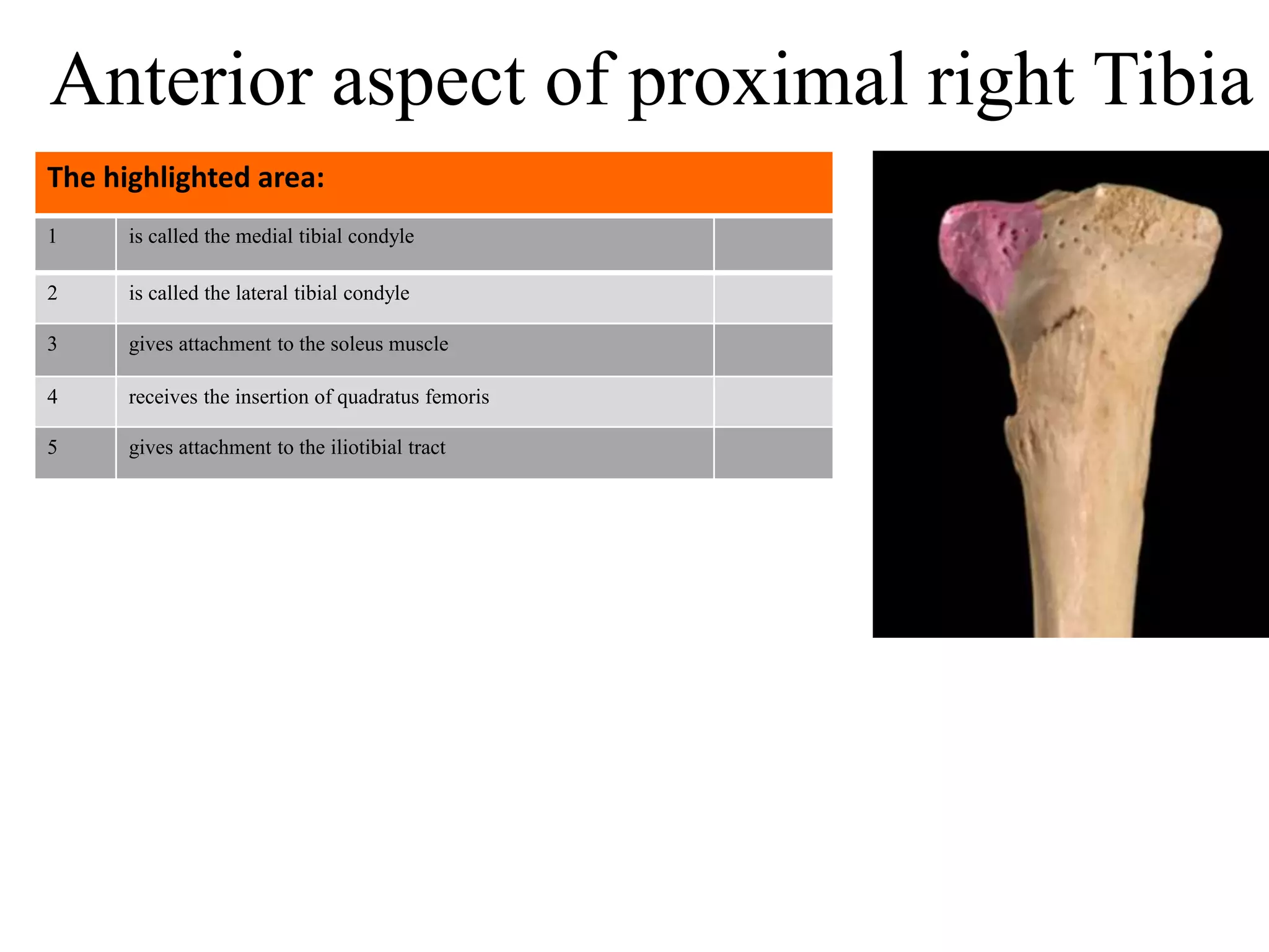 1 is called the medial tibial condyle
2 is called the lateral tibial condyle
3 gives attachment to the soleus muscle
4 receives the insertion of quadratus femoris
5 gives attachment to the iliotibial tract
The highlighted area:
Anterior aspect of proximal right Tibia
 