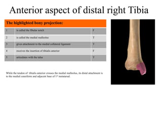 1 is called the fibular notch F
2 is called the medial malleolus T
3 gives attachment to the medial collateral ligament T
4 receives the insertion of tibialis anterior F
5 articulates with the talus T
The highlighted bony projection:
Anterior aspect of distal right Tibia
While the tendon of tibialis anterior crosses the medial malleolus, its distal attachment is
to the medial cuneiform and adjacent base of 1st metatarsal.
 