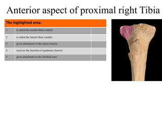 1 is called the medial tibial condyle
2 is called the lateral tibial condyle
3 gives attachment to the soleus muscle
4 receives the insertion of quadratus femoris
5 gives attachment to the iliotibial tract
The highlighted area:
Anterior aspect of proximal right Tibia
 