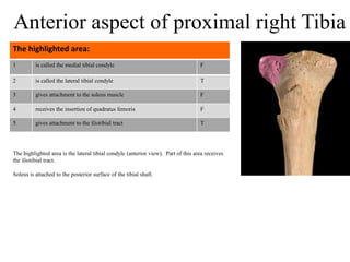 1 is called the medial tibial condyle F
2 is called the lateral tibial condyle T
3 gives attachment to the soleus muscle F
4 receives the insertion of quadratus femoris F
5 gives attachment to the iliotibial tract T
The highlighted area:
Anterior aspect of proximal right Tibia
The highlighted area is the lateral tibial condyle (anterior view). Part of this area receives
the iliotibial tract.
Soleus is attached to the posterior surface of the tibial shaft.
 