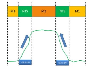 M1    NTS       M2    NTS       M1




     >60 องศา        >60 องศา
 
