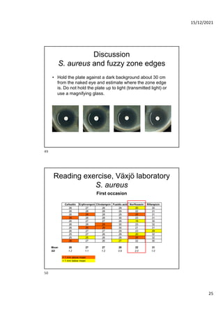 Quality control of susceptibility testing (Part 1)