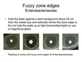 Quality control of susceptibility testing (Part 2)