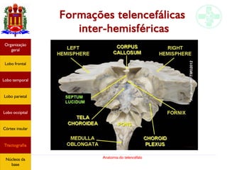 Anatomia do telencéfalo
Formações telencefálicas
inter-hemisféricas
Lobo frontal
Organização
geral
Lobo occipital
Lobo temporal
Lobo parietal
Córtex insular
Tractografia
Núcleos da
base
 