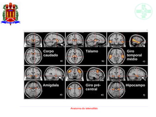 Anatomia do telencéfalo
Corpo
caudado
Tálamo Giro
temporal
médio
Giro pré-
central
Amígdala Hipocampo
 