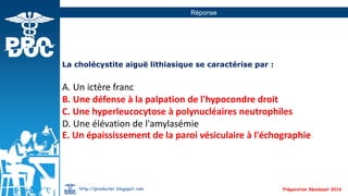 QCM - Cholécystite aigue lithiasique