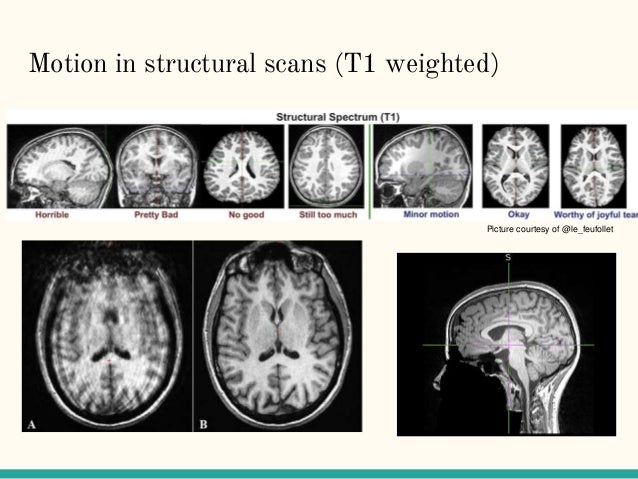 functional mri