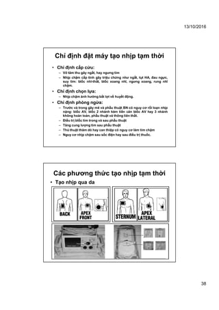 13/10/2016
38
Chỉ định đặt máy tạo nhịp tạm thời
• Chỉ định cấp cứu:
– Vô tâm thu gây ngất, hay ngưng tim
– Nhịp chậm cấp tính gây triệu chứng như ngất, tụt HA, đau ngực,
suy tim: blốc nhĩ-thất, blốc xoang nhĩ, ngưng xoang, rung nhĩ
chậm.
• Chỉ định chọn lựa:
– Nhịp chậm ảnh hưởng bất lợi về huyết động.
• Chỉ định phòng ngừa:
– Trước và trong gây mê và phẫu thuật BN có nguy cơ rối loạn nhịp
nặng: blốc AV, blốc 2 nhánh kèm tiền căn blốc AV hay 3 nhánh
không hoàn toàn, phẫu thuật vá thông liên thất.
– Điều trị blốc tim trong và sau phẫu thuật
– Tăng cung lượng tim sau phẫu thuật
– Thủ thuật thăm dò hay can thiệp có nguy cơ làm tim chậm
– Nguy cơ nhịp chậm sau sốc điện hay sau điều trị thuốc.
Các phương thức tạo nhịp tạm thời
• Tạo nhịp qua da
 