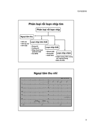 13/10/2016
4
Phân loại rối loạn nhịp tim
Phân loại rối loạn nhịp
Loạn nhịp thất
Loạn nhịp chậm
Ngoại tâm thu
Loạn nhịp trên thất NTT nhĩ
 NTT bộ nối
 NTT thất  Rung nhĩ
 Cuồng nhĩ
 Nhịp nhanh kịch
phát trên thất
 HC WPW
 Nhanh thất
 Rung thất
 Xoắn đỉnh
 Chậm xoang, blốc xoang
nhĩ, ngưng xoang
 Blốc nhĩ thất
Ngoại tâm thu nhĩ
 