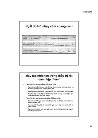 13/10/2016
46
Ngất do HC nhạy cảm xoang cảnh
Máy tạo nhịp tim trong điều trị rối
loạn nhịp nhanh
• Tạo nhịp tim trong điều trị rối loạn nhịp
– Tạo nhịp có thể chấm dứt một số nhịp nhanh: cuồng nhĩ, nhịp nhanh trên
thất kịch phát do vòng vào lại, nhanh thất.
– Loại kích thích: kích thích chương trình, kích thích nhanh một loạt ngắn
– Máy tạo nhịp có bộ phận phát hiện nhịp nhanh và hoạt hóa tự động tạo
nhịp để chấm dứt cơn nhịp nhanh.
• Tạo nhịp tim trong phòng ngừa rối loạn nhịp
– Tạo nhịp có thể ngăn ngừa một số loạn nhịp: Hc QT dài, nhanh thất phụ
thuộc khoảng nghỉ
– Tạo nhịp thất đồng bộ với nhĩ có thể ngăn ngừa nhịp nhanh trên thất do
vòng vào lại.
– Tạo nhịp nhĩ có thể hiệu quả ngăn ngừa rung nhĩ tái phát trong rung nhĩ
phụ thuộc nhịp chậm
 