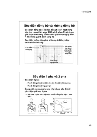 13/10/2016
49
Sốc điện đồng bộ và không đồng bộ
• Sốc điện đồng bộ: sốc điện đồng bộ với hoạt động
của tim, trong thời gian QRS (đỉnh sóng R), để tránh
giai đoạn trơ tương đối của tim (giai đoạn nguy hiểm
= 20-30 ms quanh đình sóng T).
• Sốc điện không đồng bộ: khi rung thất hay nhịp
nhanh thất đa dạng.
Chỉ điểm
đồng bộ
Sốc đồng
bộ được
phân phối
trong giai
đoạn này
Giai đoạn
nguy hiểm
Sốc điện 1 pha và 2 pha
• Sốc điện 2 pha:
– Pha 1: dòng điện đi từ bản đện âm đến bản điện dương
– Pha 2: dòng điện đi ngược lại
• Cùng một mức năng lượng như nhau, sốc điện 2
pha hiệu quả hơn 1 pha
– Sốc điện 2 pha 200J hiệu quả ít nhất bằng sốc điện 1 pha
360J.
 