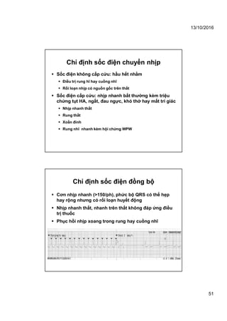 13/10/2016
51
 Sốc điện không cấp cứu: hầu hết nhằm
 Điều trị rung hĩ hay cuồng nhĩ
 Rối loạn nhịp có nguồn gốc trên thất
 Sốc điện cấp cứu: nhịp nhanh bất thường kèm triệu
chứng tụt HA, ngất, đau ngực, khó thở hay mất tri giác
 Nhịp nhanh thất
 Rung thất
 Xoẵn đỉnh
 Rung nhĩ nhanh kèm hội chứng WPW
Chỉ định sốc điện chuyển nhịp
 Cơn nhịp nhanh (>150/ph), phức bộ QRS có thể hẹp
hay rộng nhưng có rối loạn huyết động
 Nhịp nhanh thất, nhanh trên thất không đáp ứng điều
trị thuốc
 Phục hồi nhịp xoang trong rung hay cuồng nhĩ
Chỉ định sốc điện đồng bộ
 