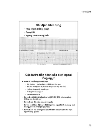 13/10/2016
52
 Nhịp nhanh thất vô mạch
 Rung thất
 Ngưng tim sau rung thất
Chỉ định khử rung
 Bước 1: chuẩn bị phương tiện
– Máy sốc điện 1 pha hay 2 pha với 2 bản sốc điện sạch
– Máy theo dõi điện tâm đồ, huyết áp động mạch, nhịp thở, sao2.
– Thuốc và dụng cụ hồi sức cấp cứu
– Thuốc giảm đau và gây mê
– Lập đường truyền TM
• Bước 2: cài đặt nút sốc đồng bộ (SYNCH ON), nếu rung thất
không cần ấn nút này
• Bước 3: cài đặt mức năng lượng sốc
• Bước 4: đặt bản điện cực đã bôi gel lên ngực bệnh nhân, áp chặt
lên ngực bệnh nhân (25 pounds)
• Bước 5: ấn nút phóng điện sau khi đảm bảo an toàn cho mọi
người xung quanh.
Các bước tiến hành sốc điện ngoài
lồng ngực
 