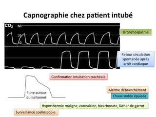 Capnographie	
  chez	
  pa@ent	
  intubé	
  
Retour	
  circula;on	
  
spontanée	
  après	
  
arrêt	
  cardiaque	
  
Bronchospasme	
  
Fuite	
  autour	
  
du	
  ballonnet	
   Chaux	
  sodée	
  épuisée	
  
Hyperthermie	
  maligne,	
  convulsion,	
  bicarbonate,	
  lâcher	
  de	
  garrot	
  
Conﬁrma;on	
  intuba;on	
  trachéale	
  
Alarme	
  débranchement	
  
Surveillance	
  coelioscopie	
  
 