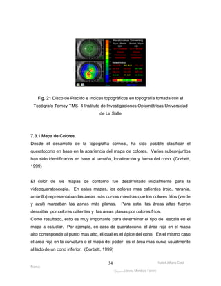 Fig. 21 Disco de Placido e índices topográficos en topografía tomada con el 
Topógrafo Tomey TMS- 4 Instituto de Investigaciones Optométricas Universidad 
7.3.1 Mapa de Colores. 
Desde el desarrollo de la topografía corneal, ha sido posible clasificar el 
queratocono en base en la apariencia del mapa de colores. Varios subconjuntos 
han sido identificados en base al tamaño, localización y forma del cono. (Corbett, 
1999) 
El color de los mapas de contorno fue desarrollado inicialmente para la 
videoqueratoscopía. En estos mapas, los colores mas calientes (rojo, naranja, 
amarillo) representaban las áreas más curvas mientras que los colores fríos (verde 
y azul) marcaban las zonas más planas. Para esto, las áreas altas fueron 
descritas por colores calientes y las áreas planas por colores fríos. 
Como resultado, esto es muy importante para determinar el tipo de escala en el 
mapa a estudiar. Por ejemplo, en caso de queratocono, el área roja en el mapa 
alto corresponde al punto más alto, el cual es el ápice del cono. En el mismo caso 
el área roja en la curvatura o el mapa del poder es el área mas curva usualmente 
al lado de un cono inferior. (Corbett, 1999) 
Isabel Johana Coral 
Franco 
de La Salle 
ltéÅ|Üt Lorena Mendoza Forero 
34 
 