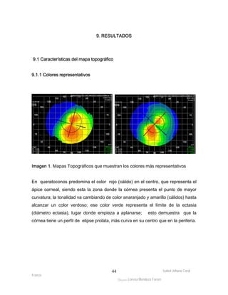 Isabel Johana Coral 
9.1 Características del mapa topográfico 
Franco 
9. RESULTADOS 
ltéÅ|Üt Lorena Mendoza Forero 
44 
9.1.1 Colores representativos 
Imagen 1. Mapas Topográficos que muestran los colores más representativos 
En queratoconos predomina el color rojo (cálido) en el centro, que representa el 
ápice corneal, siendo esta la zona donde la córnea presenta el punto de mayor 
curvatura; la tonalidad va cambiando de color anaranjado y amarillo (cálidos) hasta 
alcanzar un color verdoso; ese color verde representa el límite de la ectasia 
(diámetro ectasia), lugar donde empieza a aplanarse; esto demuestra que la 
córnea tiene un perfil de elipse prolata, más curva en su centro que en la periferia. 
 