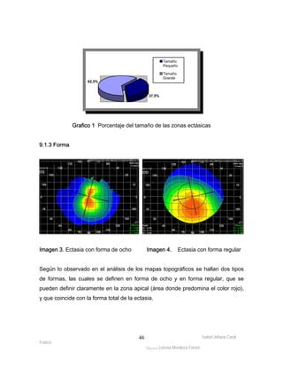 Isabel Johana Coral 
Franco 
ltéÅ|Üt Lorena Mendoza Forero 
46 
62,5% 
37,5% 
Tamaño 
Pequeño 
Tamaño 
Grande 
Grafico 1 Porcentaje del tamaño de las zonas ectásicas 
9.1.3 Forma 
Imagen 3. Ectasia con forma de ocho Imagen 4. Ectasia con forma regular 
Según lo observado en el análisis de los mapas topográficos se hallan dos tipos 
de formas, las cuales se definen en forma de ocho y en forma regular, que se 
pueden definir claramente en la zona apical (área donde predomina el color rojo), 
y que coincide con la forma total de la ectasia. 
 