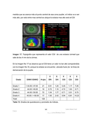 medida que se acerca más al punto central de esa zona pupilar, el índice va a ser 
más alto; por esto entre mas central se ubique la ectasia mas alto será el CSI 
Imagen 17. Topografía que representa el valor CSI de una ectasia corneal que 
sale de los 4 mm de la córnea. 
En la imagen No 17 se observa que el CSI tiene un valor no tan alto comparándola 
con la imagen No.16, porque la ectasia se encuentra ubicada fuera de la línea de 
demarcación de la pupila. 
Isabel Johana Coral 
Grado 
SIMK1/SIMK2 
# ojos 
Franco 
ltéÅ|Üt Lorena Mendoza Forero 
60 
X 
SRI 
X 
SAI 
X 
OSI 
X 
CSI 
X 
DSI 
Grado 1 > 44.00 / 47.00 21 0.61 1.20 5.45 1.17 7.26 
Grado 2 44.00 / 49.00 18 0.72 1.16 4.72 1.63 6.71 
Grado 3 44.00 / 50.00 72 1.04 1.77 6.71 3.51 9.75 
Grado 4 45.00 / > 60.00 17 1.50 2.42 9.94 6.81 14.23 
Total 128 
Tabla 13. Grados de queratocono y promedio de índices. 
 