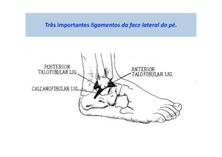 Três importantes ligamentos da face lateral do pé.
 