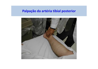 Palpação da artéria tibial posterior
 