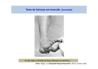 Teste de Estresse em Inversão (tornozelo)
A seta indica a direção da força aplicada ao calcanhar.
Fonte: Magee, D J; Orthopedic Physical Assessment , 4th Ed., Elseiver- 2002
 