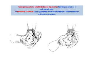 Teste para avaliar a estabilidade dos ligamentos talofibular anterior e
calcaneofibular.
O tornozelo é instável se os ligamentos talofibular anterior e calcaneofibular
estiverem rompidos.
 