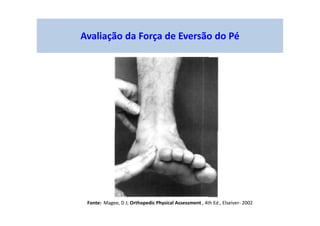 Avaliação da Força de Eversão do Pé
Fonte: Magee, D J; Orthopedic Physical Assessment , 4th Ed., Elseiver- 2002
 