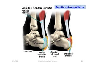 10/12/2015 Dr. José Heitor Machado Fernandes 210
Bursite retroaquiliana
 