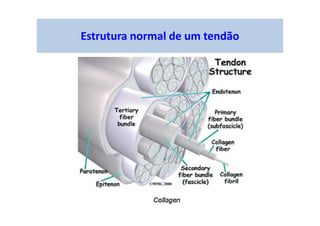 Estrutura normal de um tendão
 
