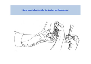 Bolsa sinovial do tendão de Aquiles ou Calcaneano.
 