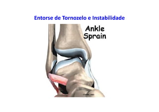 Entorse de Tornozelo e Instabilidade
 