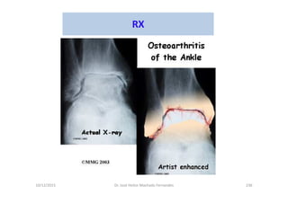 10/12/2015 Dr. José Heitor Machado Fernandes 236
RX
 