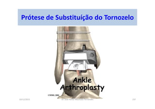 10/12/2015 Dr. José Heitor Machado Fernandes 237
Prótese de Substituíção do Tornozelo
 