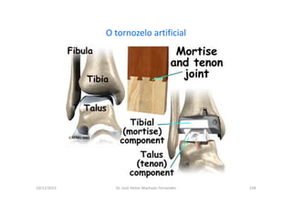 10/12/2015 Dr. José Heitor Machado Fernandes 238
O tornozelo artificial
 