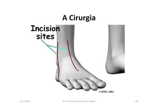 10/12/2015 Dr. José Heitor Machado Fernandes 244
A Cirurgia
 