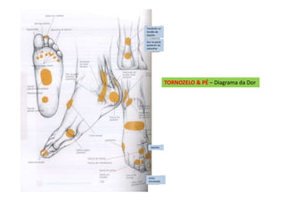 TORNOZELO & PÉ – Diagrama da Dor
Tendinite no
tendão de
Aquiles
Dor na parte
posterior do
calcanhar
Joanete
Unha
encravada
 