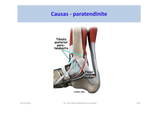 10/12/2015 Dr. José Heitor Machado Fernandes 254
Causas - paratendinite
 