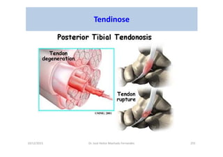 10/12/2015 Dr. José Heitor Machado Fernandes 255
Tendinose
 