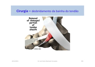 10/12/2015 Dr. José Heitor Machado Fernandes 256
Cirurgia – desbridamento da bainha do tendão
 