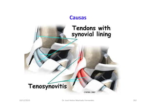10/12/2015 Dr. José Heitor Machado Fernandes 262
Causas
 