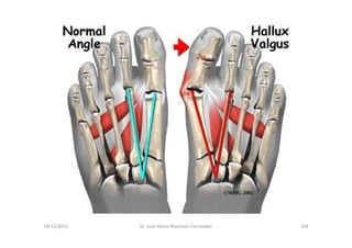 10/12/2015 Dr. José Heitor Machado Fernandes 294
 
