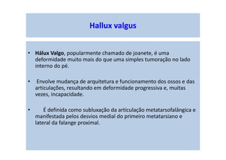 Hallux valgus
• Hálux Valgo, popularmente chamado de joanete, é uma
deformidade muito mais do que uma simples tumoração no lado
interno do pé.
• Envolve mudança de arquitetura e funcionamento dos ossos e das
articulações, resultando em deformidade progressiva e, muitas
vezes, incapacidade.
• É definida como subluxação da articulação metatarsofalângica e
manifestada pelos desvios medial do primeiro metatarsiano e
lateral da falange proximal.
 