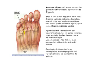 As metatarsalgias constituem-se em uma das
queixas mais freqüentes da especialidade de
Ortopedia.
Entre as causas mais freqüentes desse tipos
de dor na região do metatarso, chamado de
ante-pé, existe uma patologia causada por
uma neurite plantar dos nervos digitais, que é
conhecida por neuroma de Morton.
Alguns casos tem sido resolvidos por
tratamento clínico, mas em grande número de
vezes, a solução do alívio da dor é com o
tratamento cirúrgico.
Mas em cerca de 14% a 21% dos casos
operados há recidiva da dor e da lesão
nervosa.
Os métodos de diagnóstico foram
aperfeiçoados, mas esse progresso não
superam a história e o exame clínico do
paciente.
 