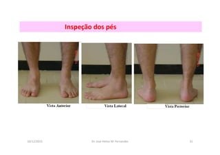 10/12/2015 Dr. José Heitor M. Fernandes 31
Inspeção dos pés
 