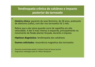Tendinopatia crônica do calcâneo e impacto
posterior do tornozelo
•
História clínica: paciente do sexo feminino, de 28 anos, praticante
de atletismo (salto), com dor nos tornozelos há 1 mês.
Refere que a dor piora quando corre de sapatilha em alta
velocidade. A dor é mais intensa à esquerda, principalmente no
movimento de flexão plantar forçada, durante o impulso.
Hipótese diagnóstica: tendinopatia dos calcâneos
Exames solicitados: ressonância magnética dos tornozelos
• Paciente encaminhada peloDr. Cristiano Frota de Souza Laurino
• Diagnóstico radiológico pelo Dr. Milton Miszputen
 