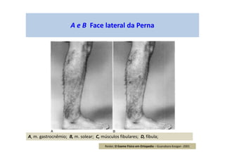 A e B Face lateral da Perna
A, m. gastrocnêmio; B, m. solear; C, músculos fibulares; D, fíbula;
Reider, O Exame Físico em Ortopedia – Guanabara Koogan -2001
 
